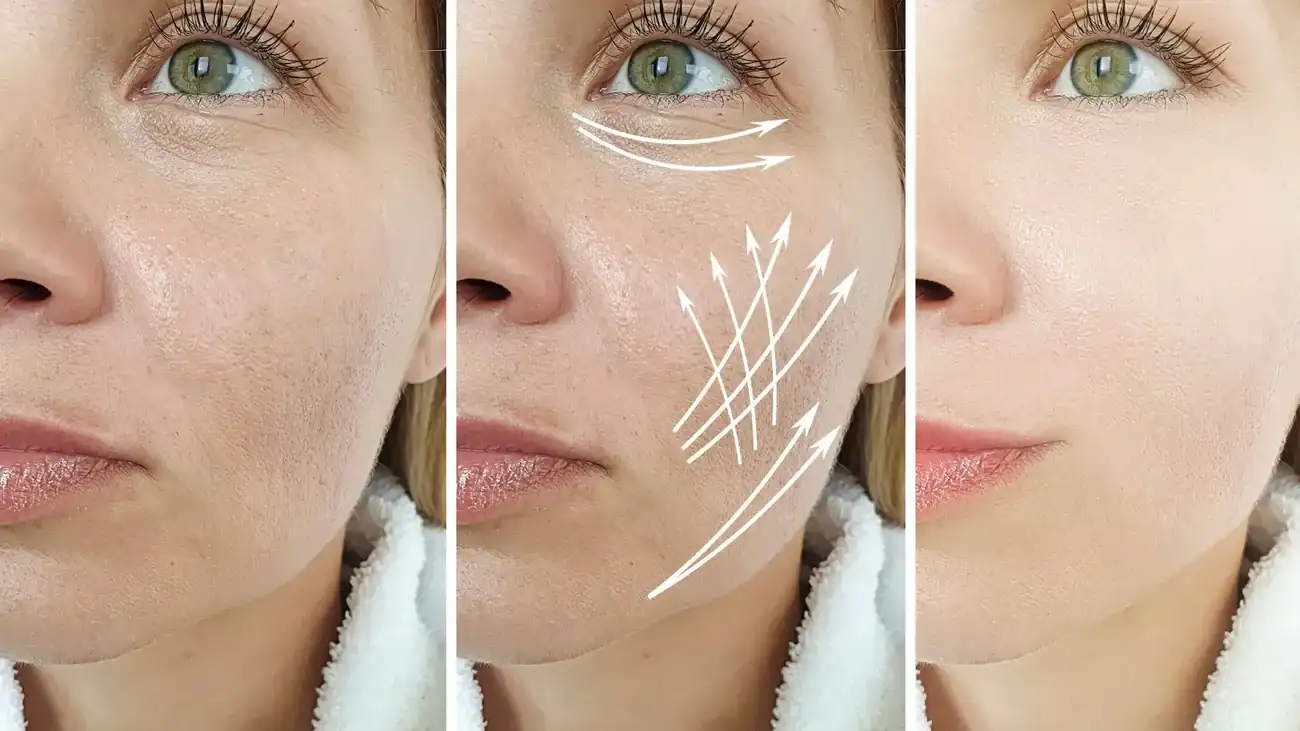 Can One Treatment Really Tackle More Than One Skin Concern Telford?