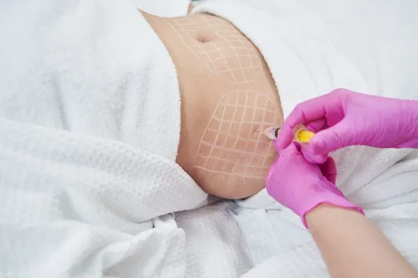 image of fat dissolving injections on love handles to help combat weight gain Telford