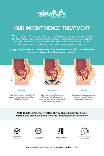 image to show how EMS treatment works for female urinary incontinence Telford