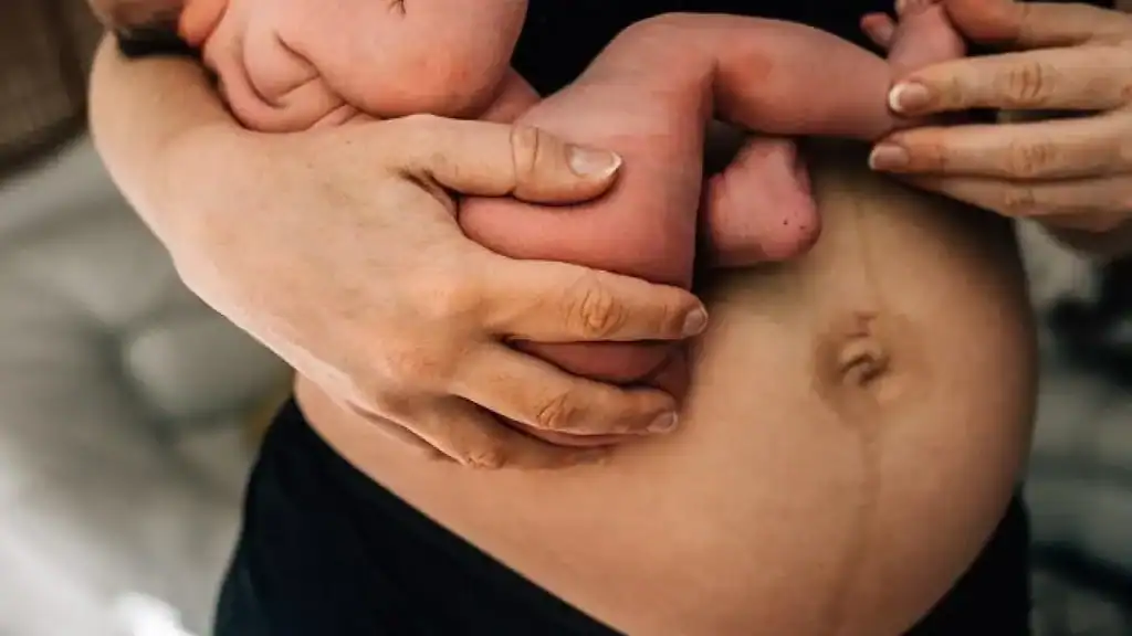 Why Is My Stomach Still Big After Pregnancy Telford?
